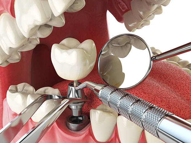 Best Emergency Tooth Extraction in East Bernard, TX